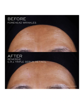 4 - Rénergie C.R.X. Triple Serum Retinol 20ml